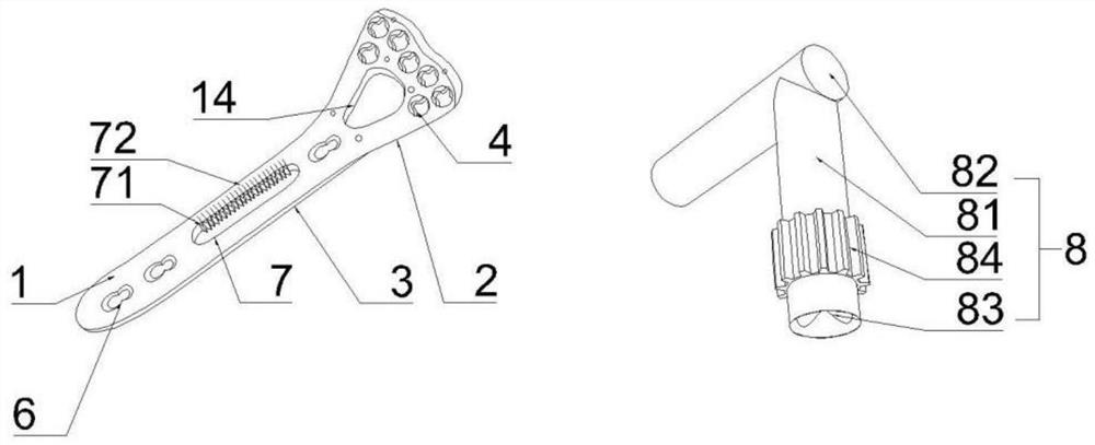 Distal radius bone setting steel plate capable of assisting in distraction reduction