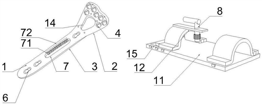 Distal radius bone setting steel plate capable of assisting in distraction reduction