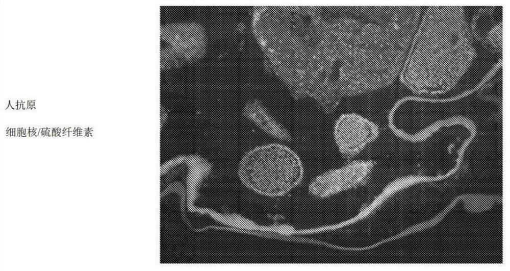 Macro-encapsulated therapeutic cells, devices, and methods of using the same