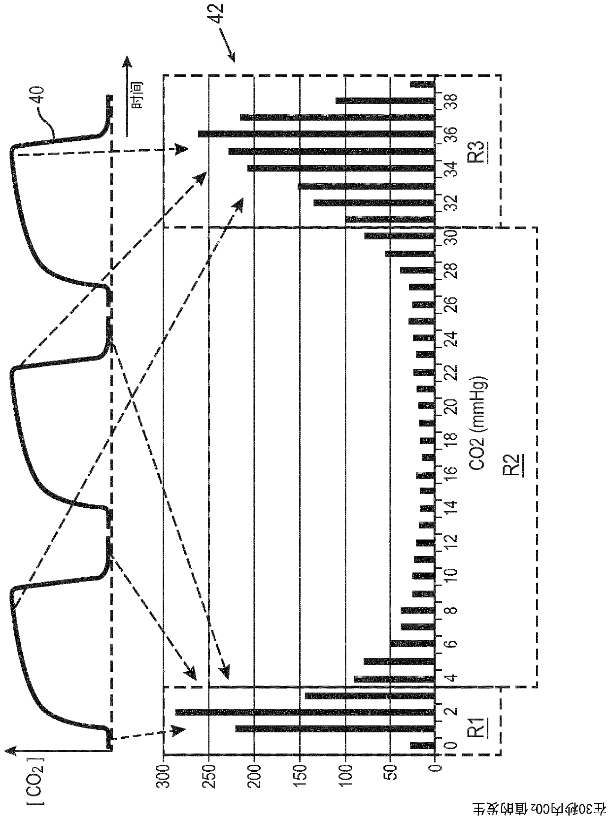 Physiologic monitoring decision support system combining capnometry and oxygen saturation