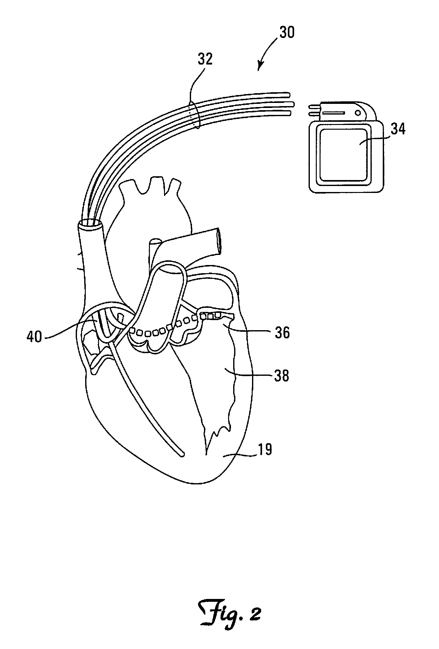 Active surveillance of implanted medical leads for lead integrity