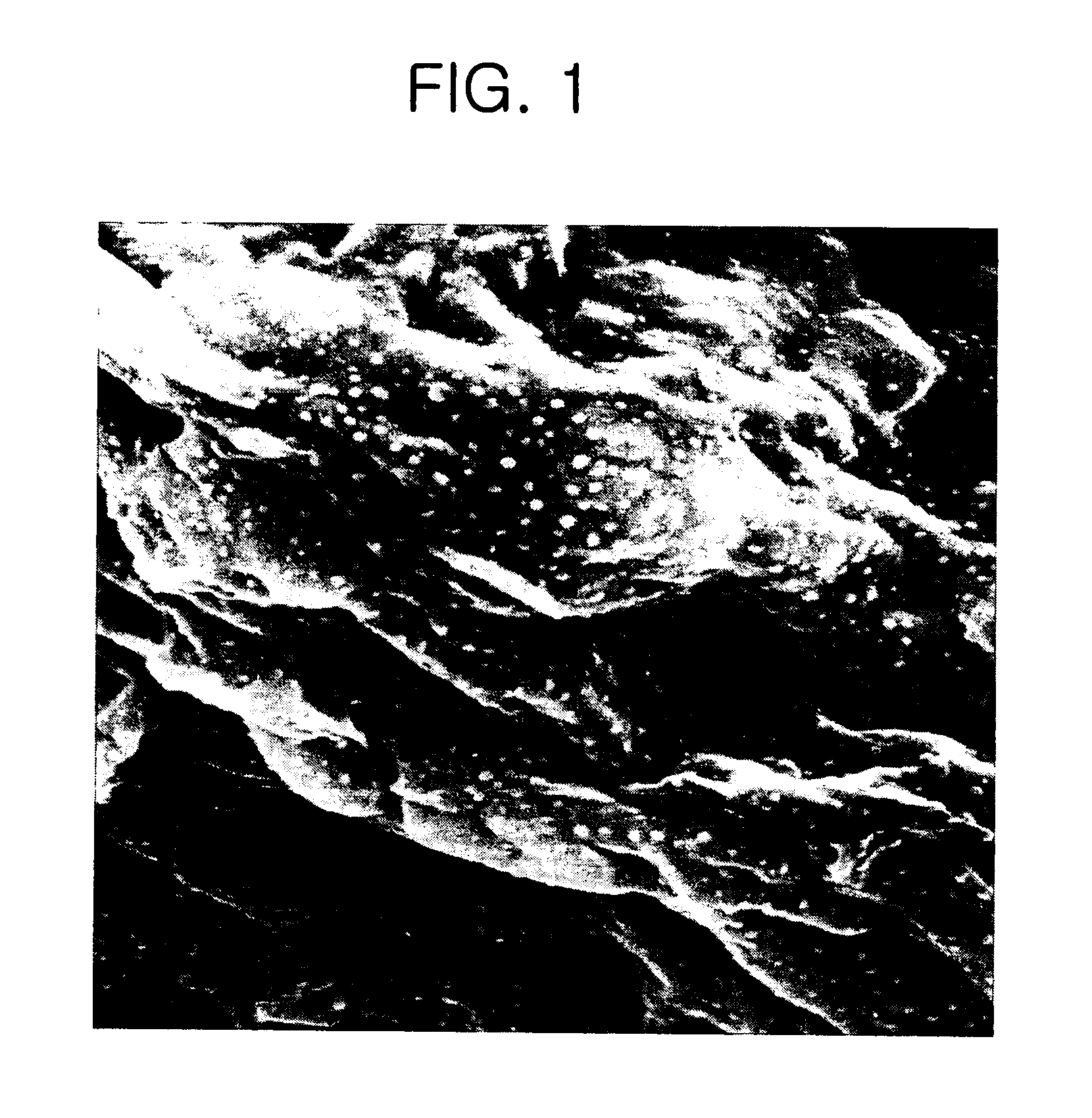 Composition for improving skin conditions comprising human growth hormone as an active ingredient