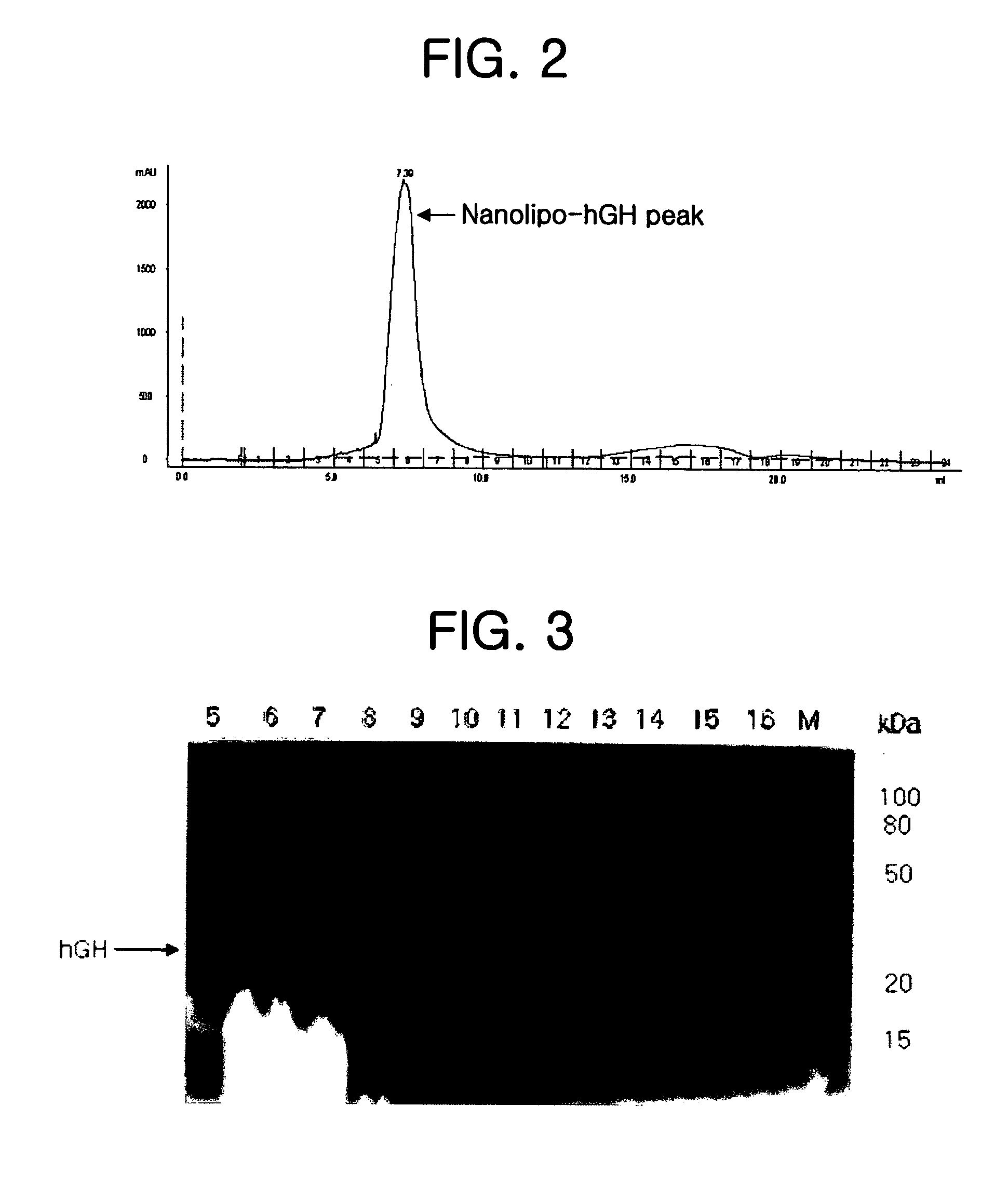 Composition for improving skin conditions comprising human growth hormone as an active ingredient