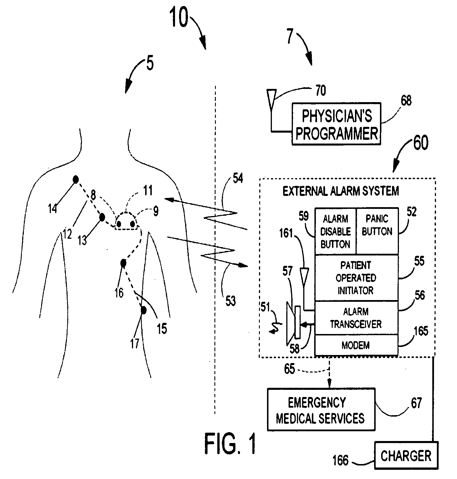 Hopping methods for the detection of QRS onset and offset