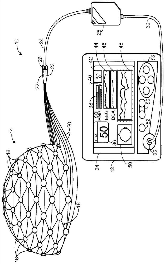 Systems and methods for detecting stroke