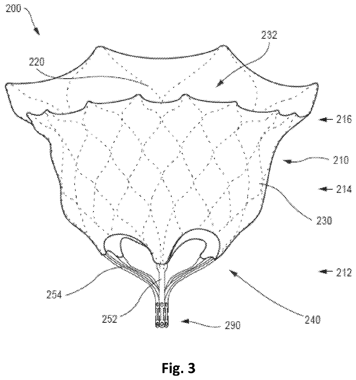 Apparatus And Methods For Delivery Of A Prosthetic Valve Within An Existing Implanted Prosthetic Valve