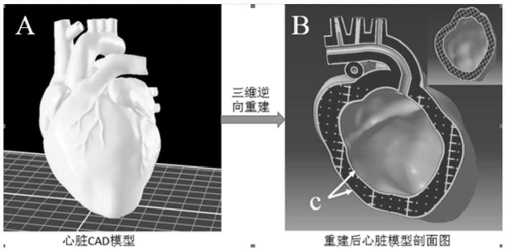 Method for constructing hollow vascularized heart based on 3D bioprinting technology and hollow vascularized heart