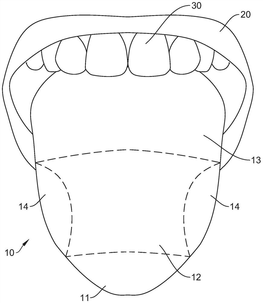 Method for analyzing physical conditions from tongue