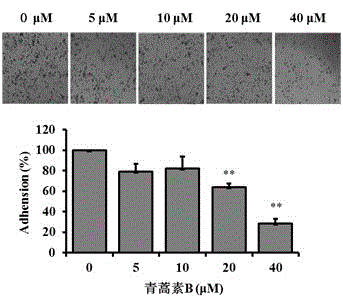 Effect of artemisinin B in A549 cell migration and invasion inhibition