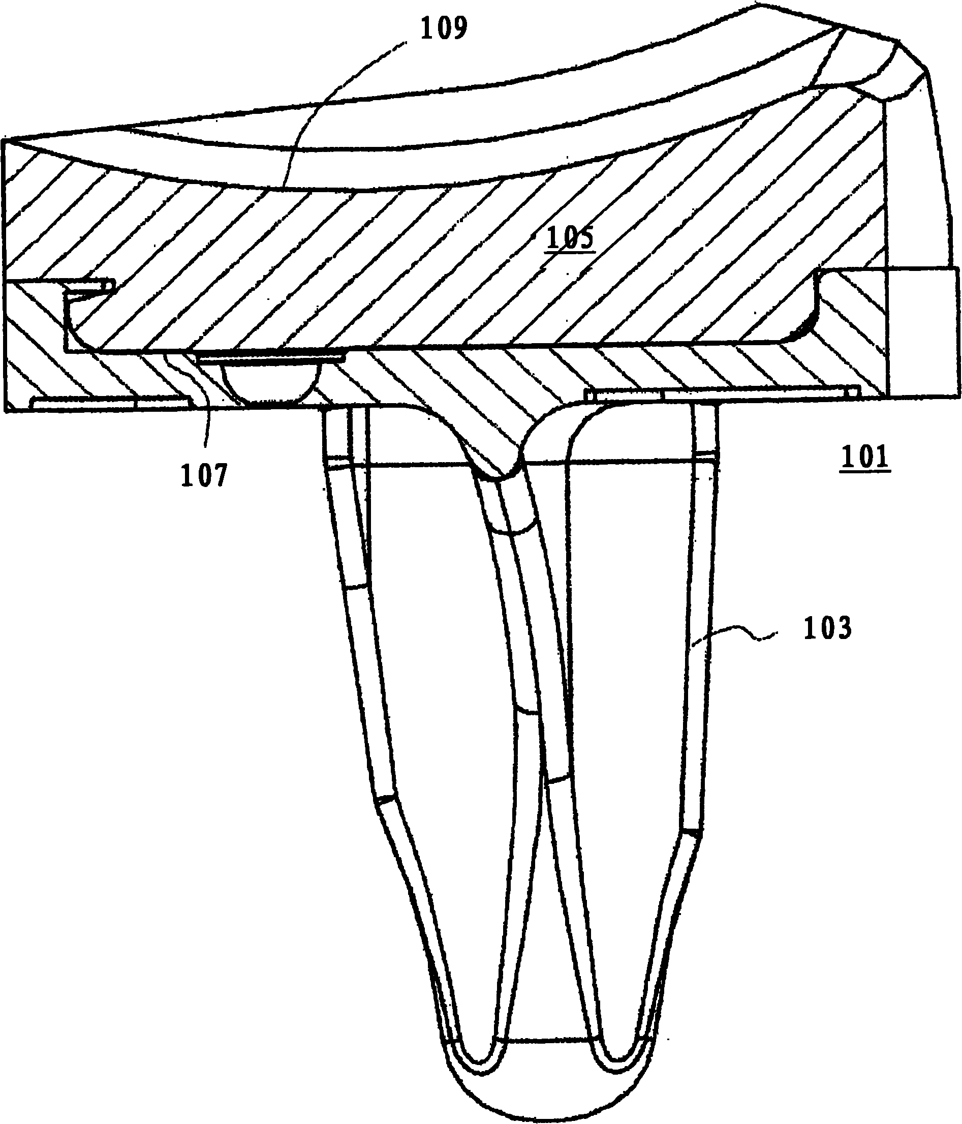 Knee prosthesis system with slope