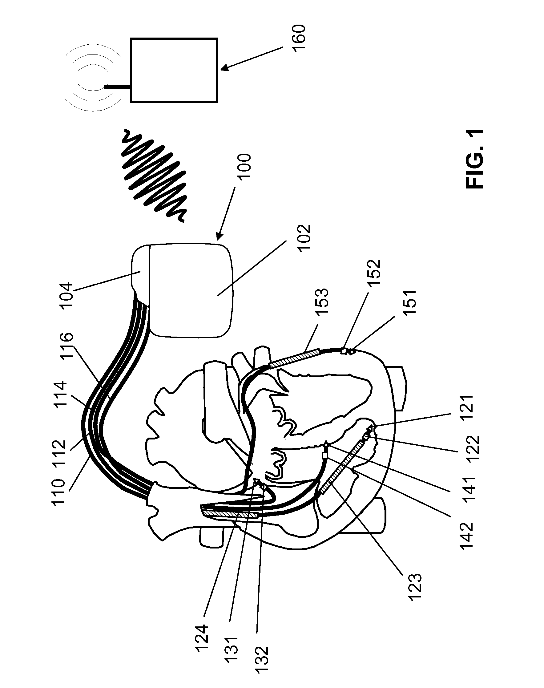 Cardiac stimulator for delivery of cardiac contractility modulation therapy