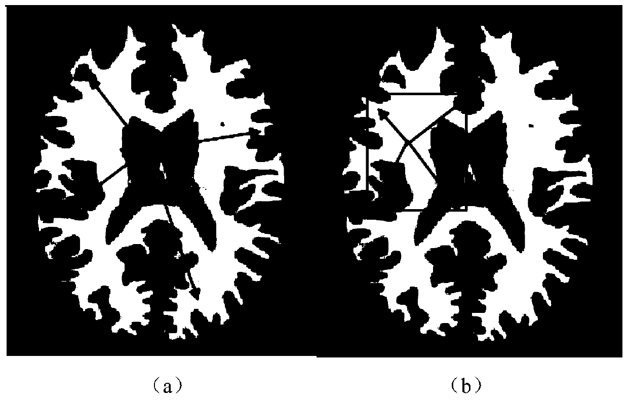 A method for supervoxel generation of brain magnetic resonance images based on prior knowledge
