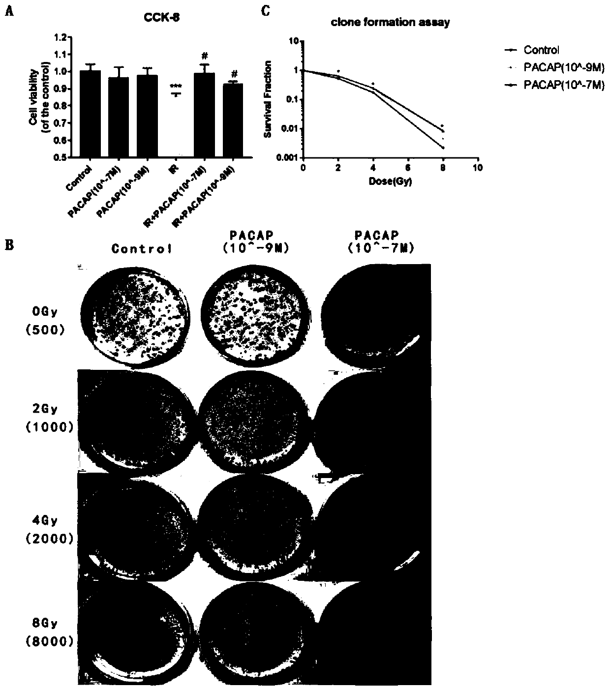 Application of bioactive polypeptide PACAP