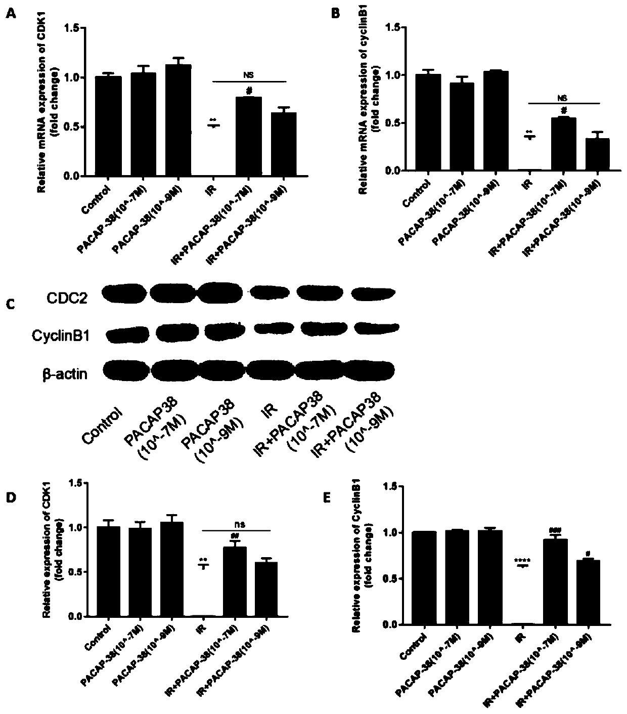 Application of bioactive polypeptide PACAP