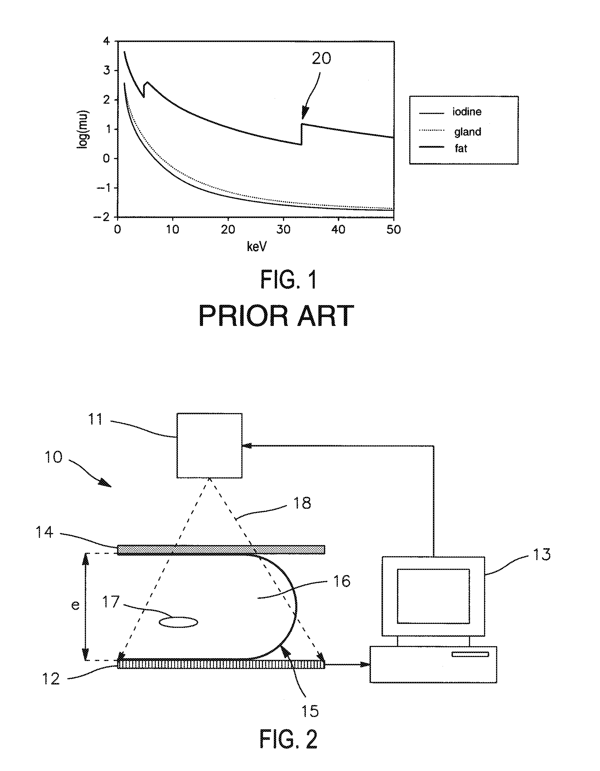 Method of processing radiological images, and, in particular, mammographic images