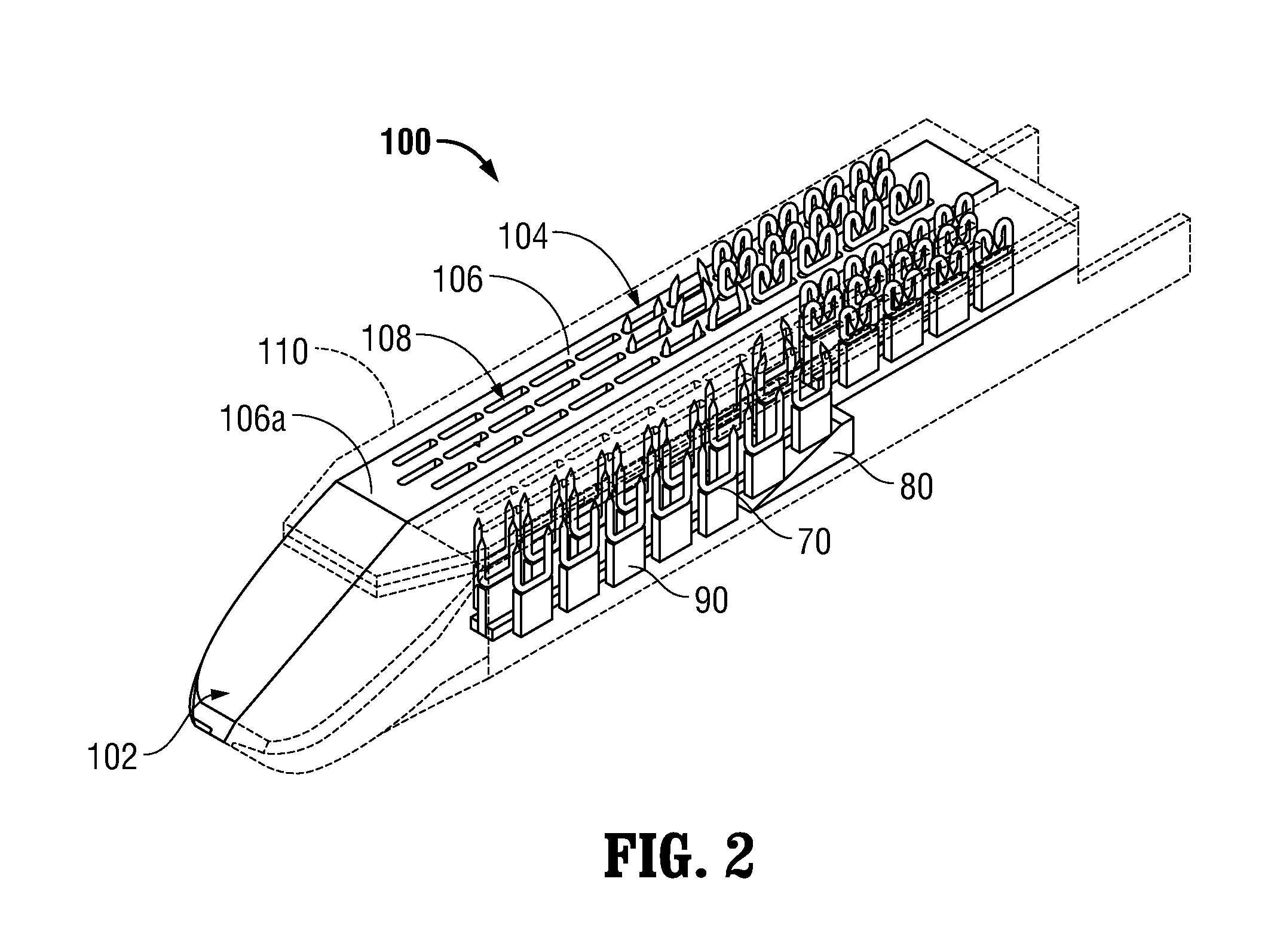 Surgical apparatus including surgical buttress