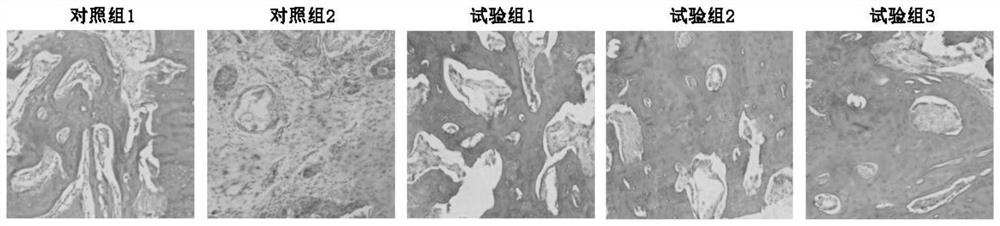 Rehmannia glutinosa polysaccharide/xenogeneic calcined allo-bone composite bone repair material