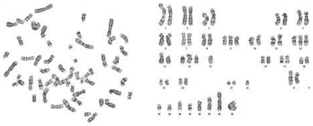 A Chinese lung adenocarcinoma cell line and its application