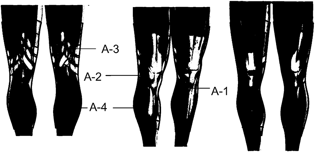 Dynamic Biofunctional Leg Guards