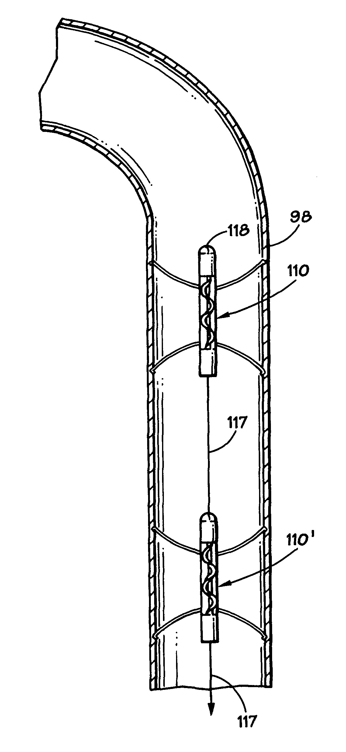 Method and apparatus for long-term assisting a left ventricle to pump blood