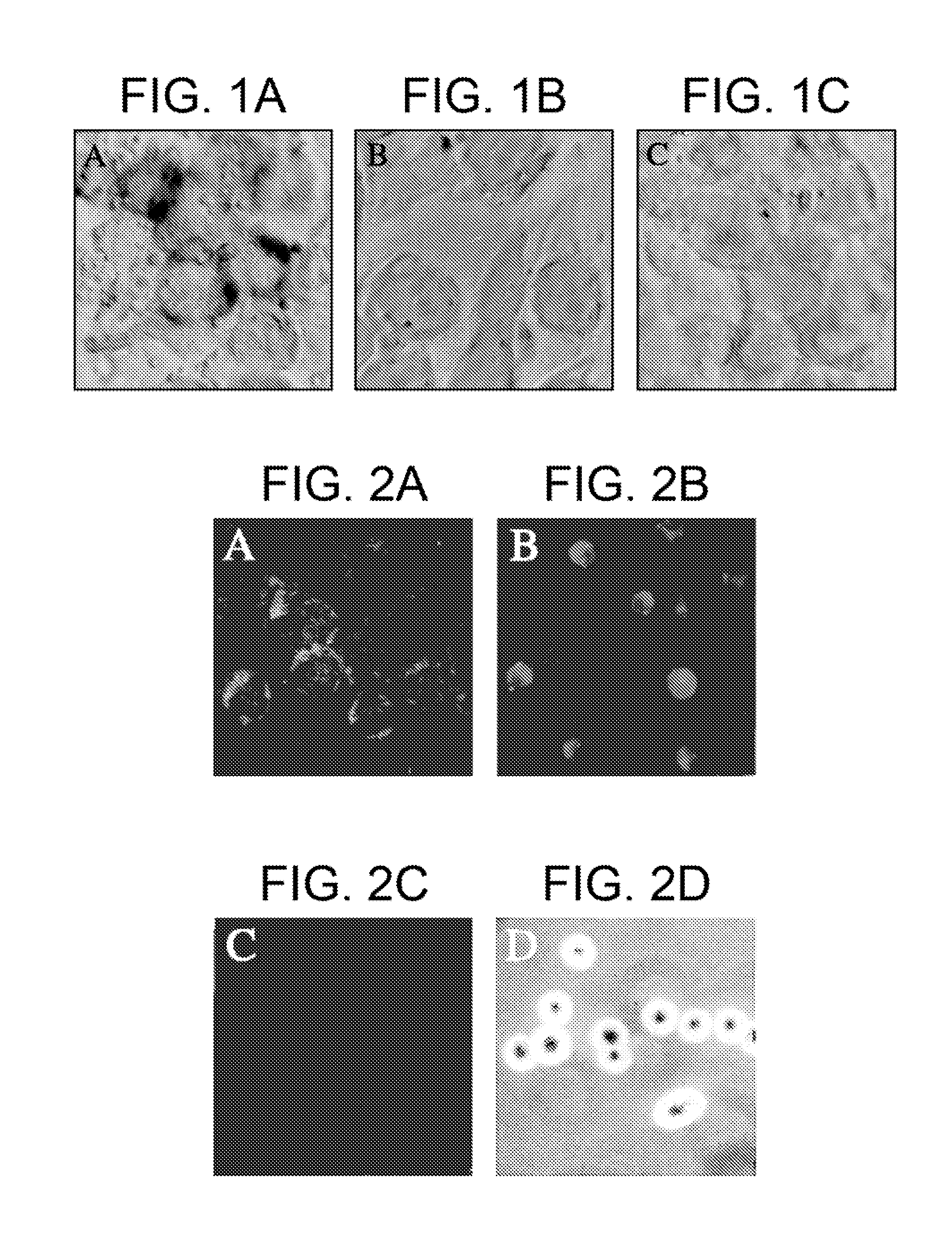 Method of inhibiting infection by HCV, other flaviviridae viruses, and any other virus that complexes to low density lipoprotein or to very low density lipoprotein in blood by preventing viral entry into a cell