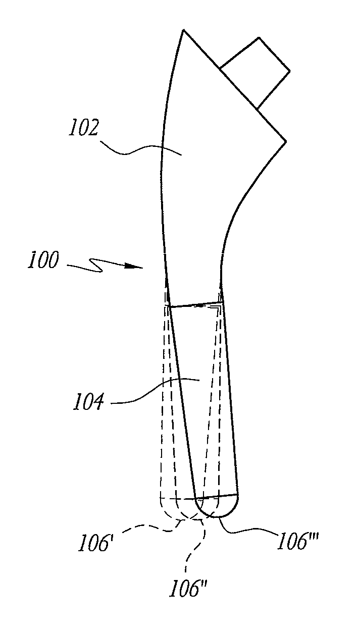 Femoral and humeral stem geometry and implantation method for orthopedic joint reconstruction