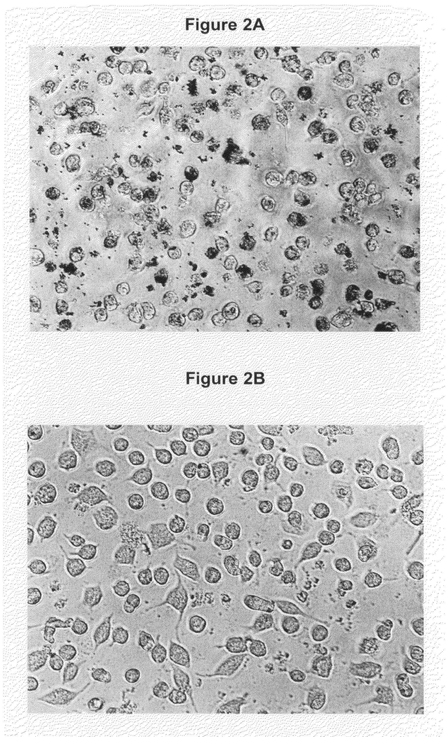 Macrophage transfection method