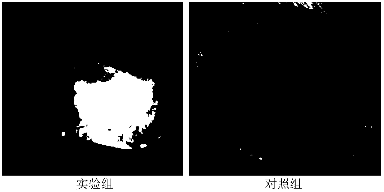 Herpes simplex virus keratitis vaccine and preparation method thereof