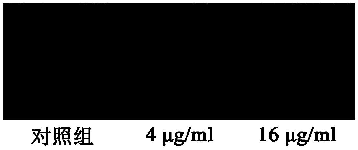 Application of Phloretin in Preparation of Medicine for Treating Chicken Necrotic Enteritis