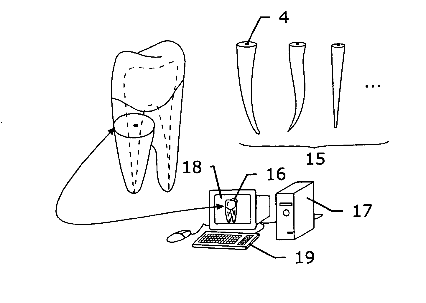 Method and system for establishing the shape of the occlusal access cavity in endodontic treatment