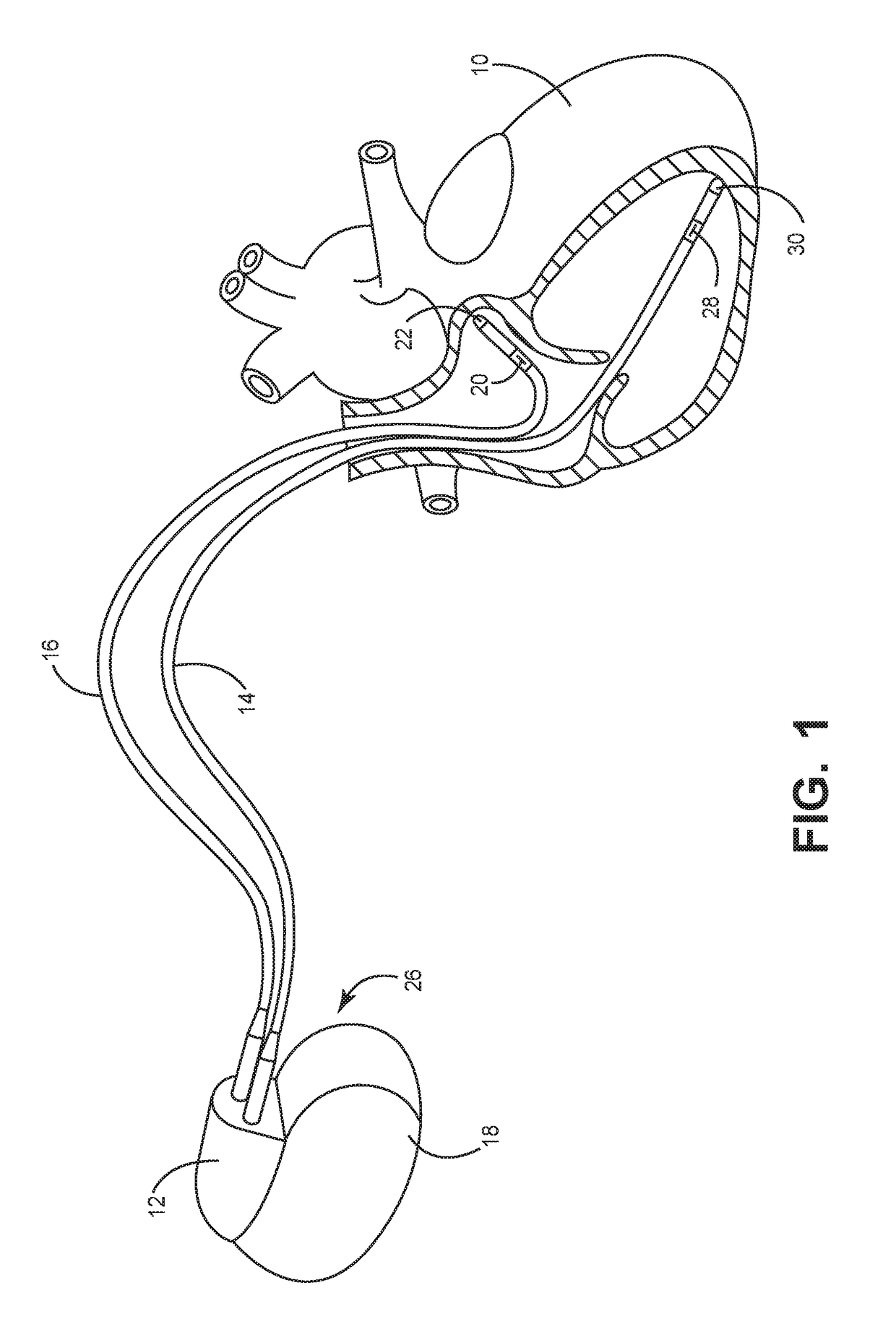 Dynamic capture management safety margin