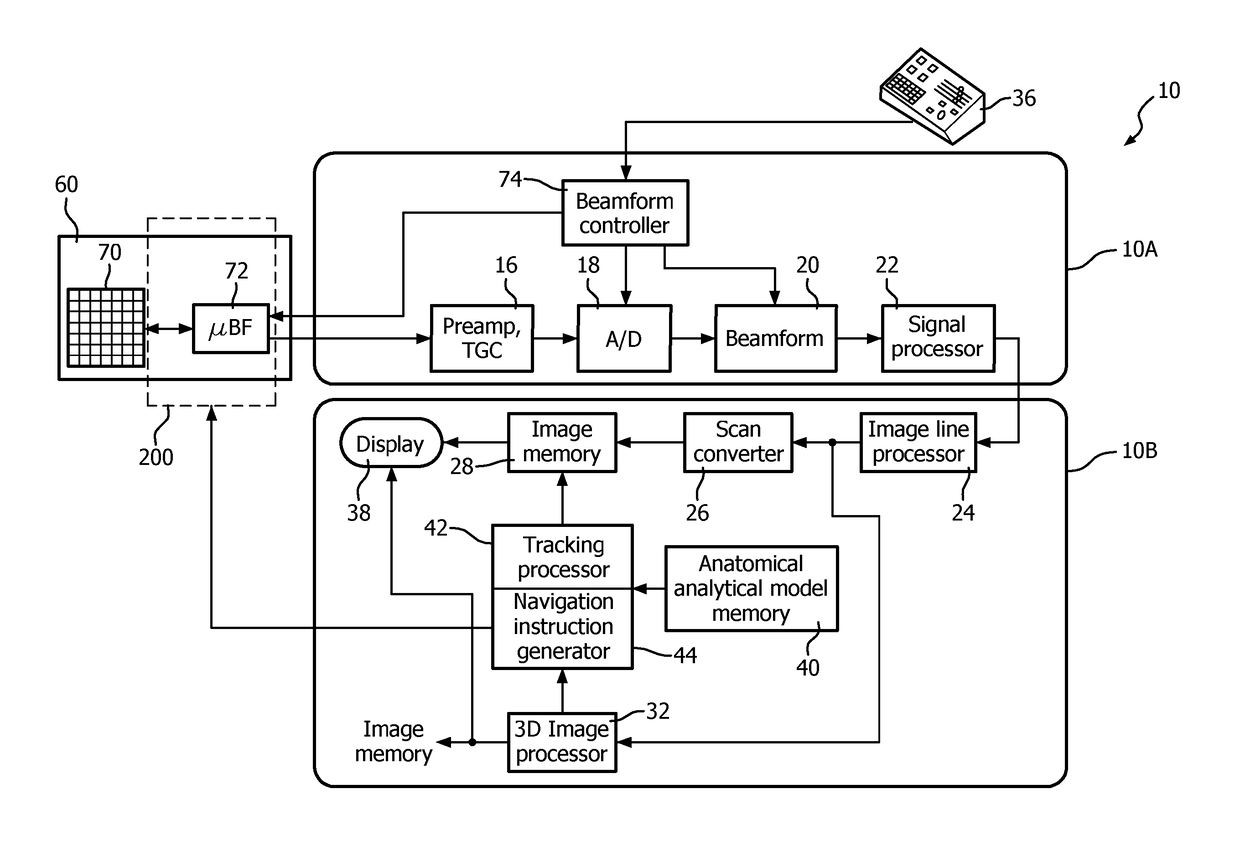 Haptic feedback for ultrasound image acquisition