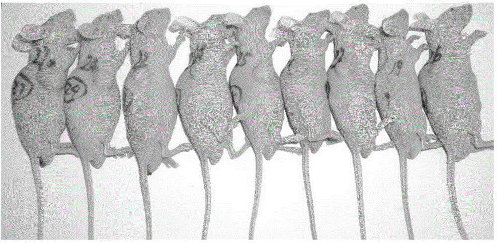 Application of sulphur in preparation of composition for inhibiting tumors