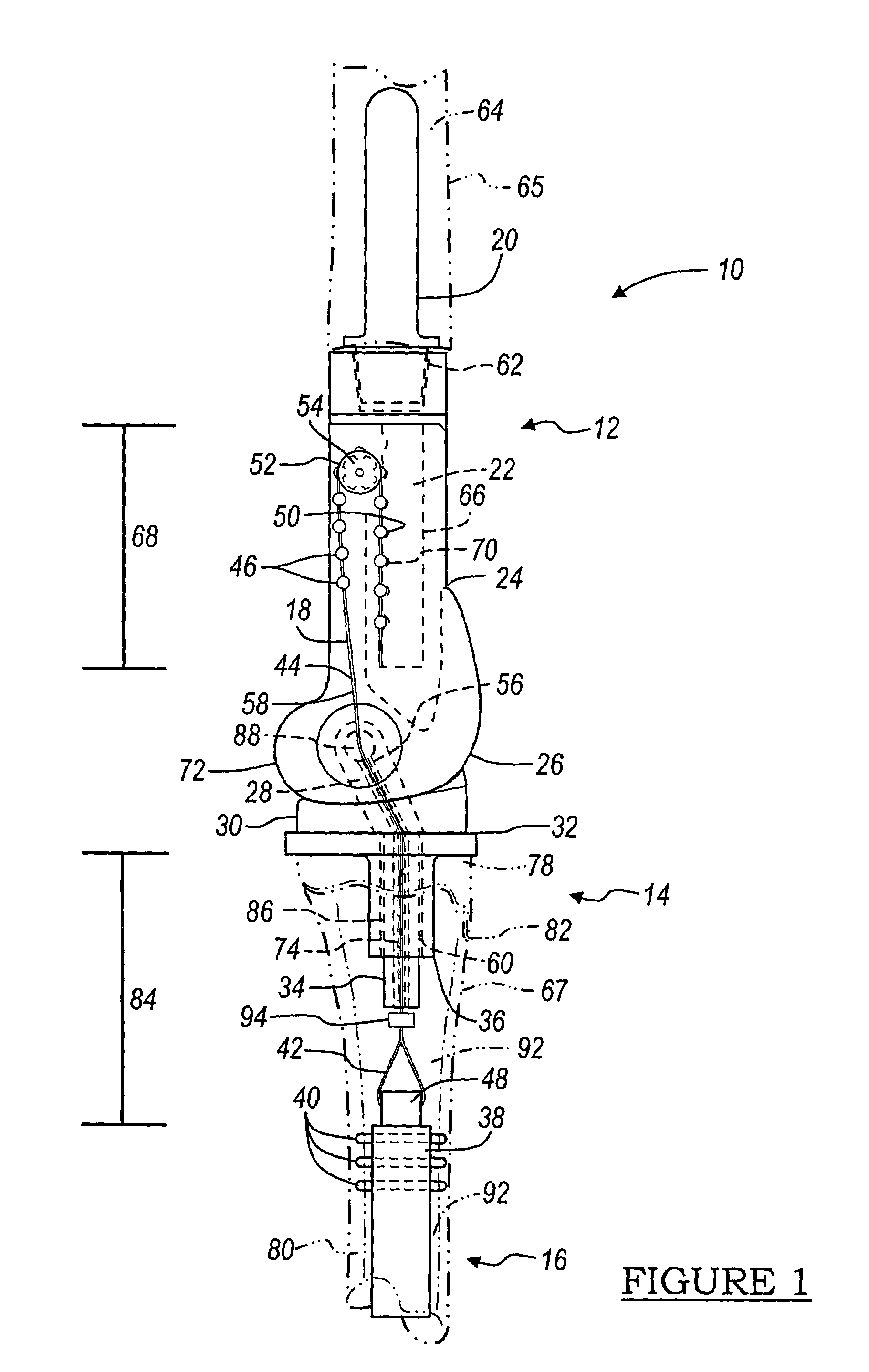 Method and apparatus for use of a non-invasive expandable implant