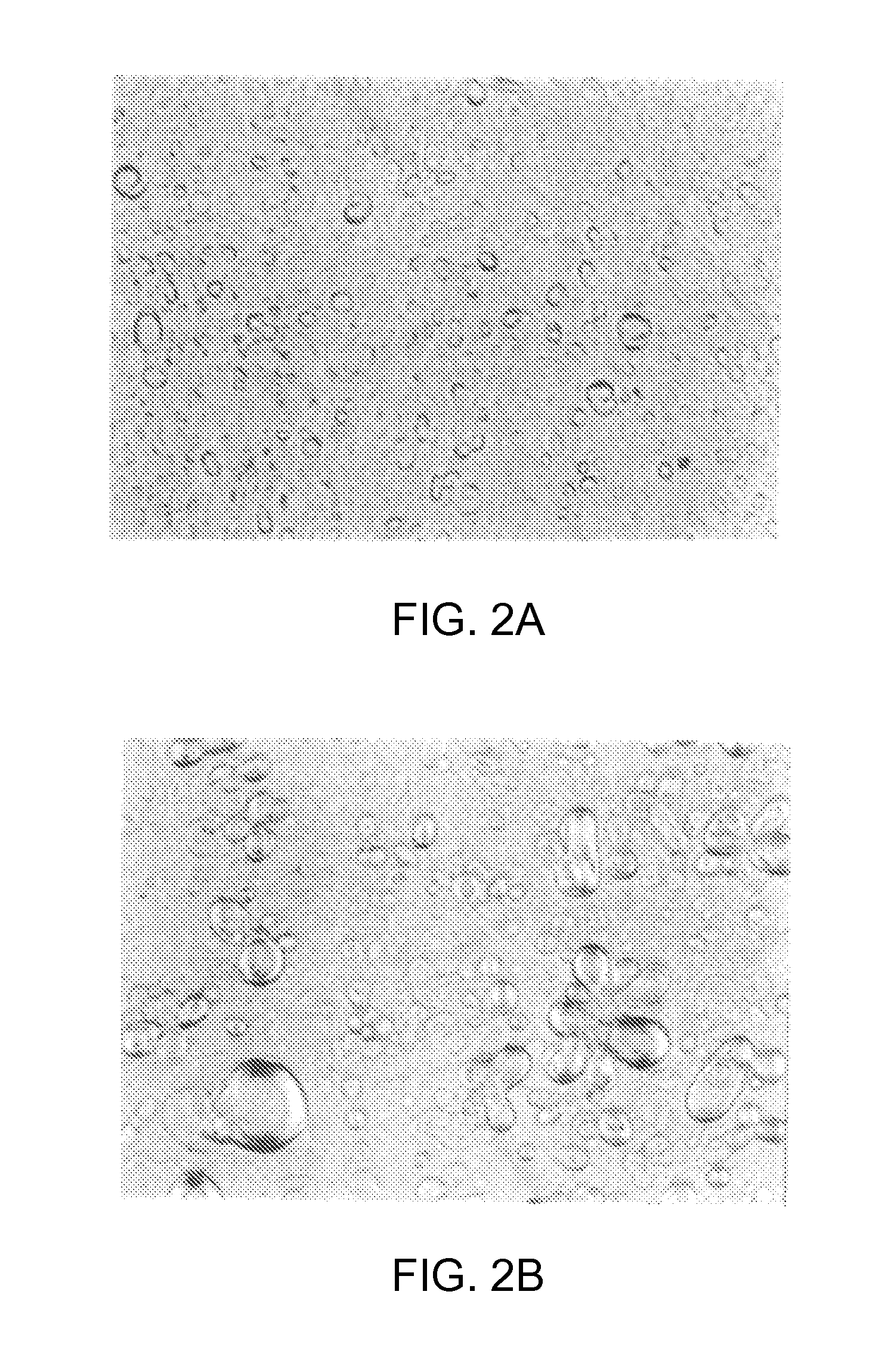 Biphasic lipid-vesicle composition and method for treating cervical dysplasia by intravaginal delivery