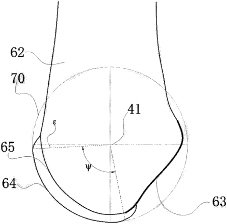 Medial femoral single condyle prosthesis, lateral femoral single condyle prosthesis, and femoral trochlea prosthesis