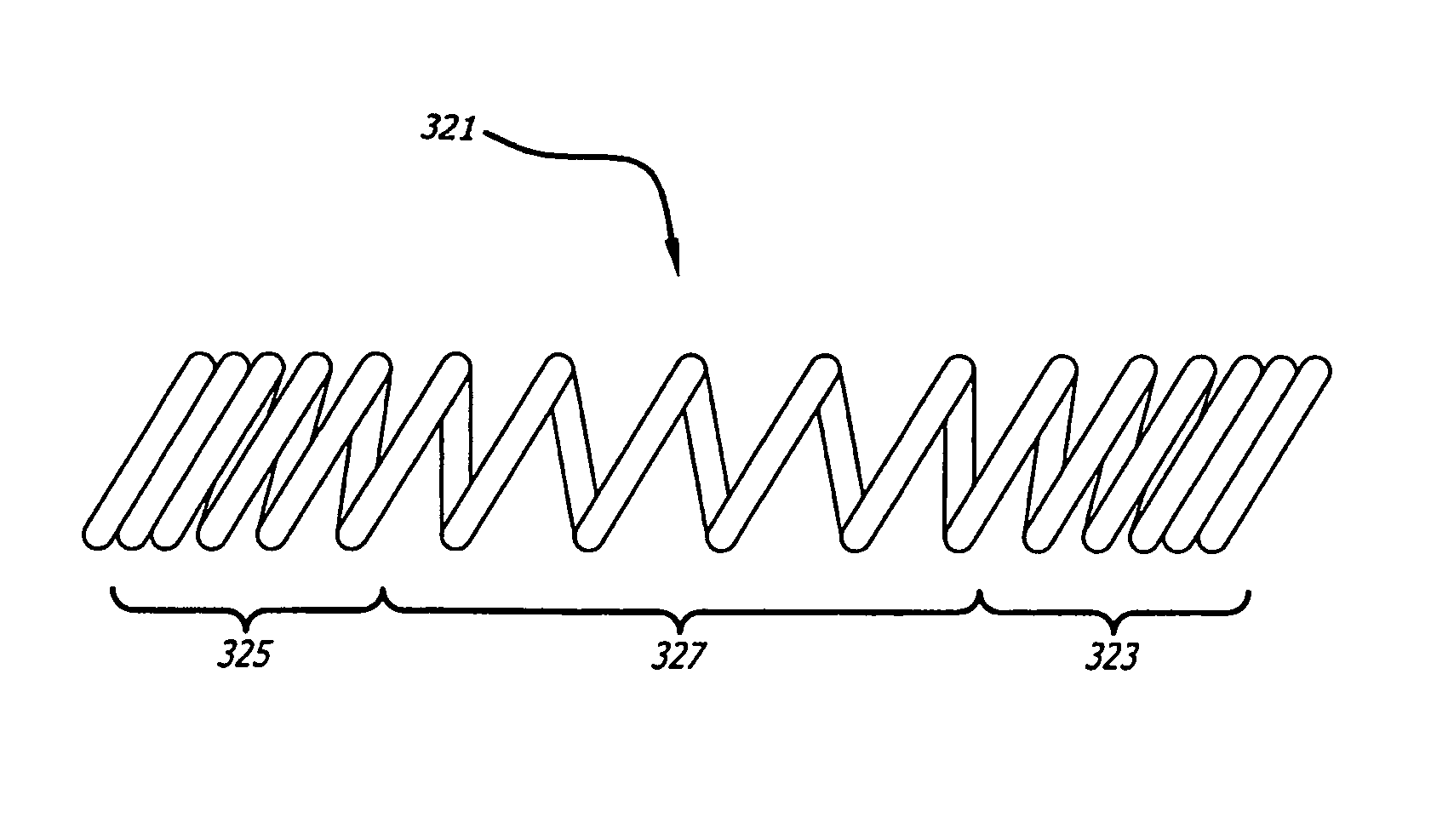 Tracheobronchial implantable medical device and methods of use