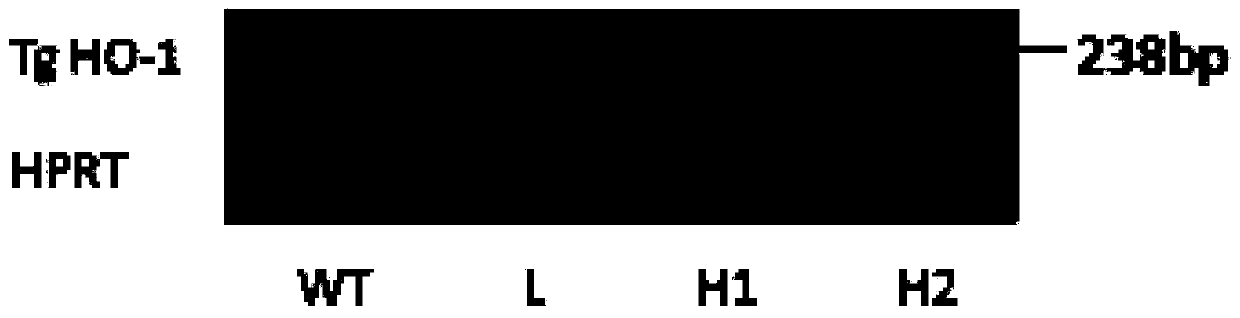 Method for generating HO-1/APP/PSEN1 triple-transgenic Alzheimer disease mouse model