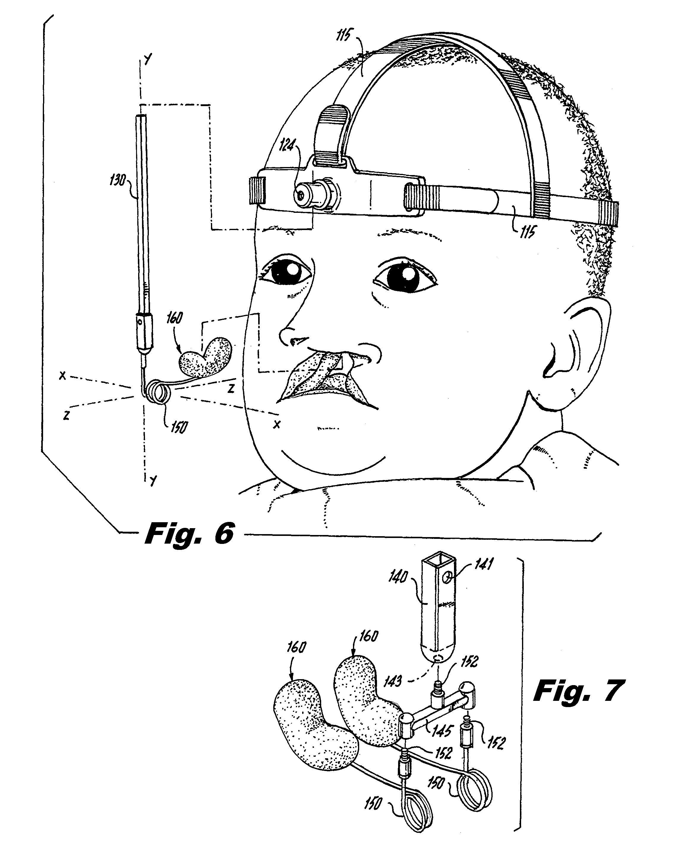 Extraoral nasal molding headgear device for the treatment of cleft lip and palate