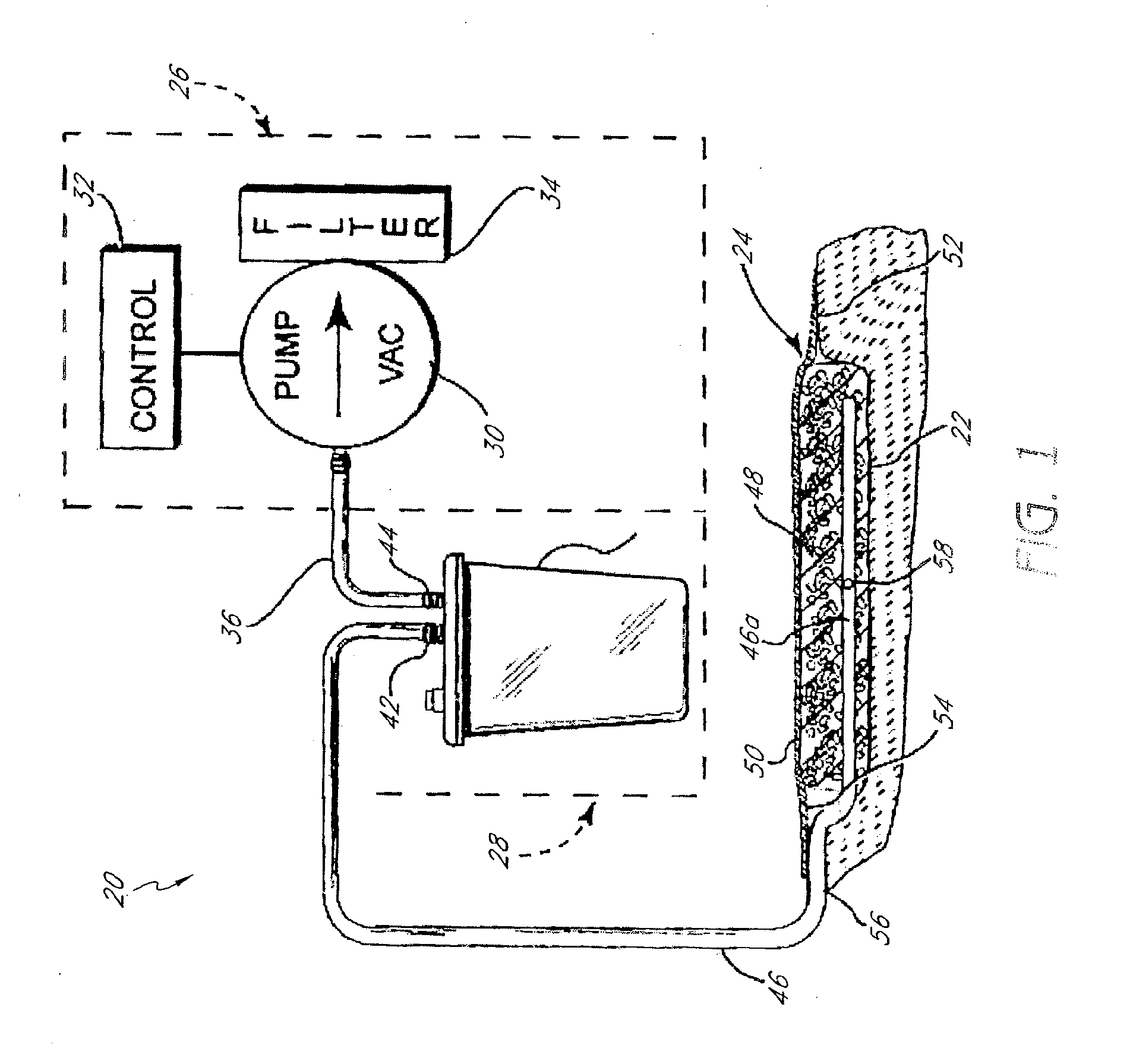 Control circuit and method for negative pressure wound treatment apparatus