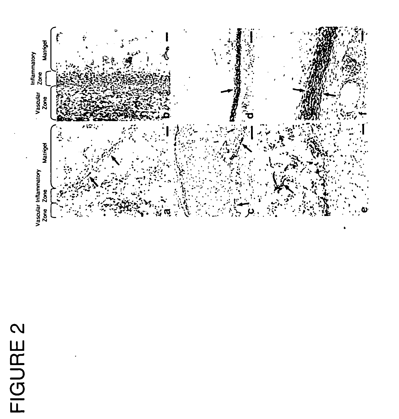 Method of reducing angiogenesis