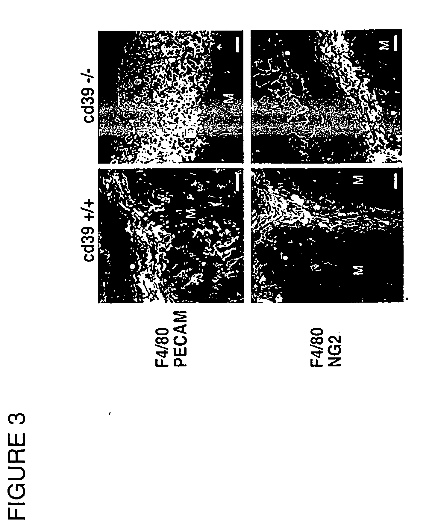 Method of reducing angiogenesis