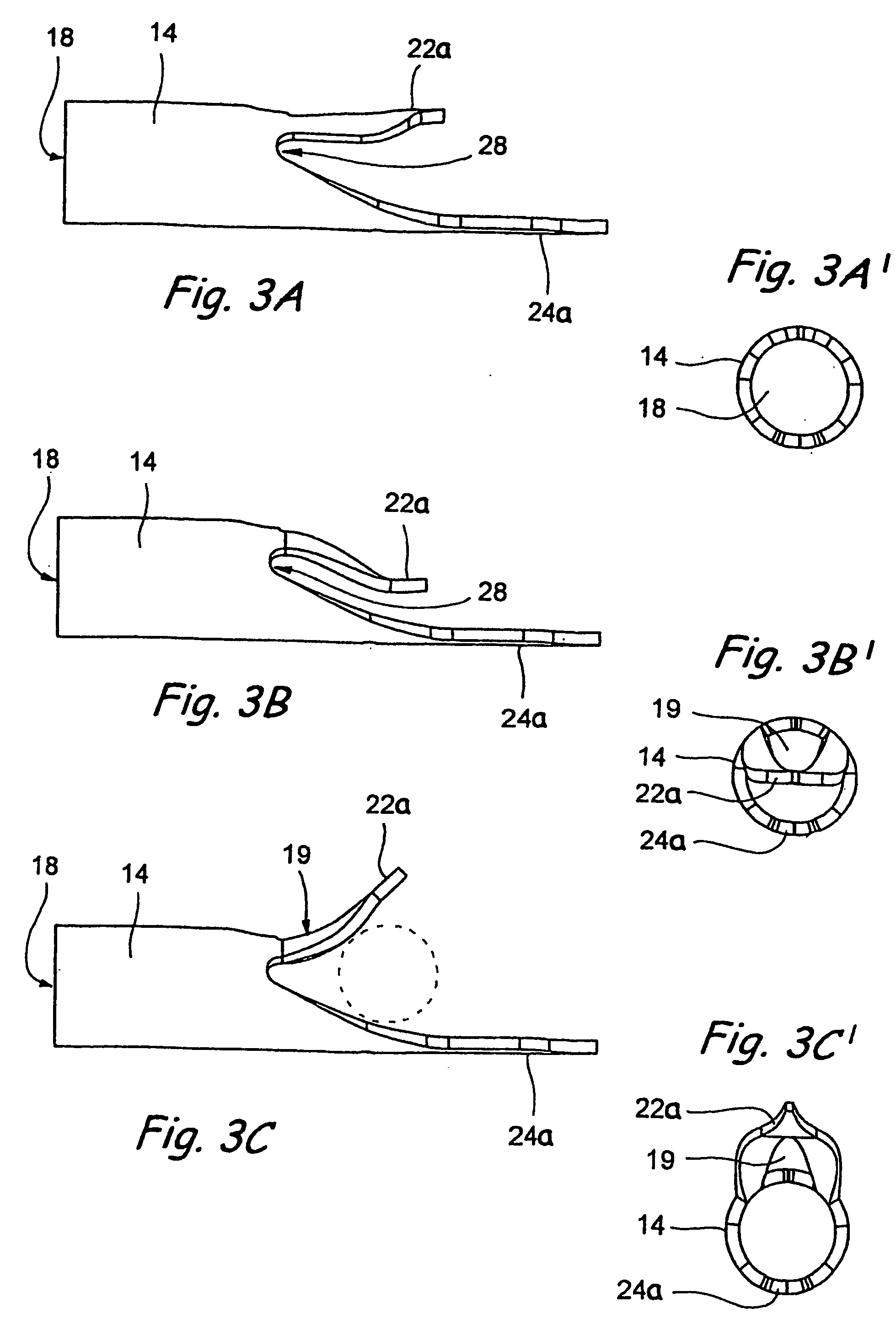 Device and methods useable for treatment of glaucoma and other surgical procedures