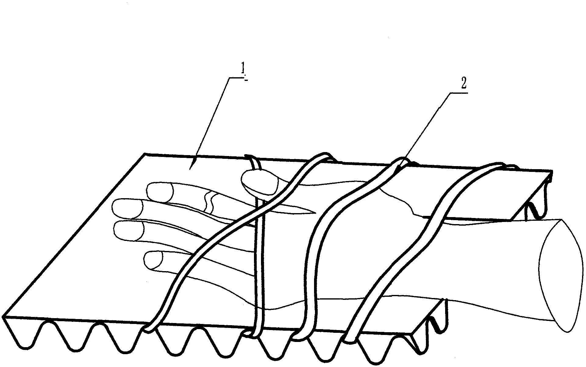 Fixed bracket for replantation of severed palms and fingers of hand