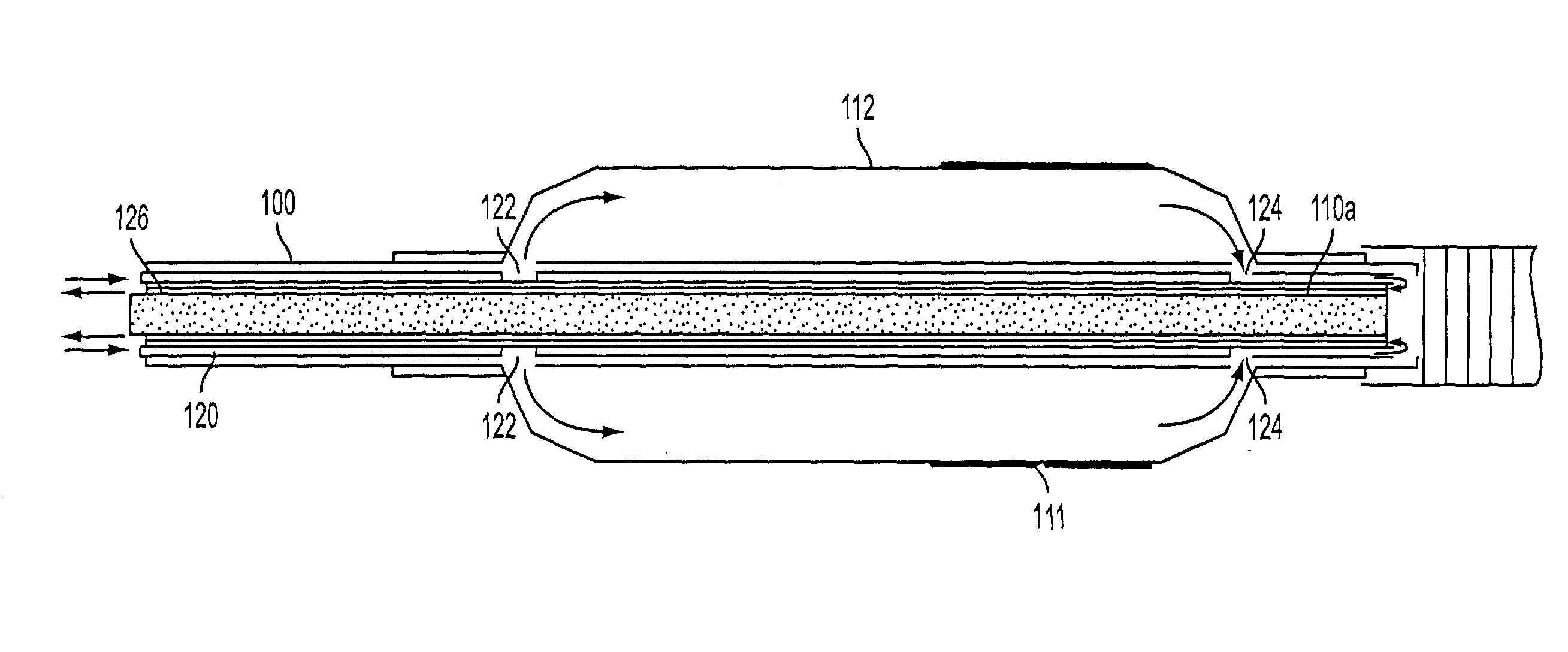 Apparatus for treatment of tissue adjacent a bodily conduit with a gene or drug-coated compression balloon