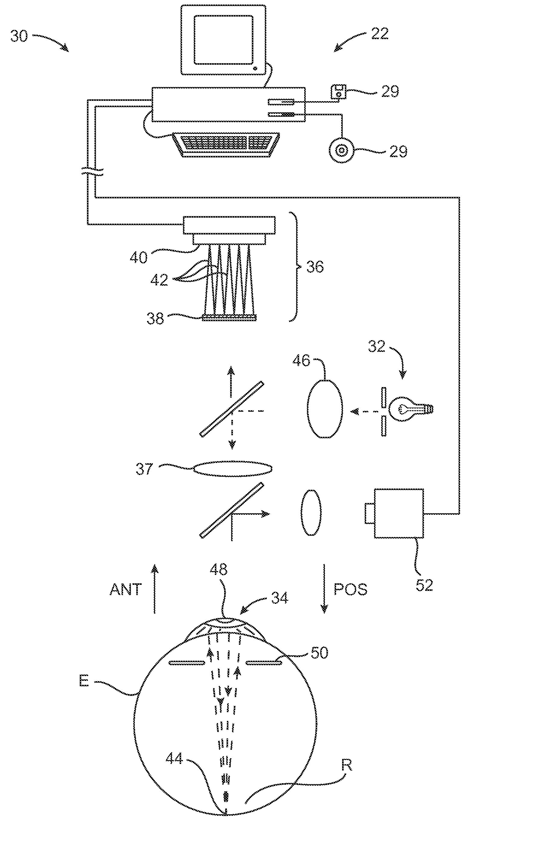 Closed Loop System and Method for Ablating Lenses with Aberrations
