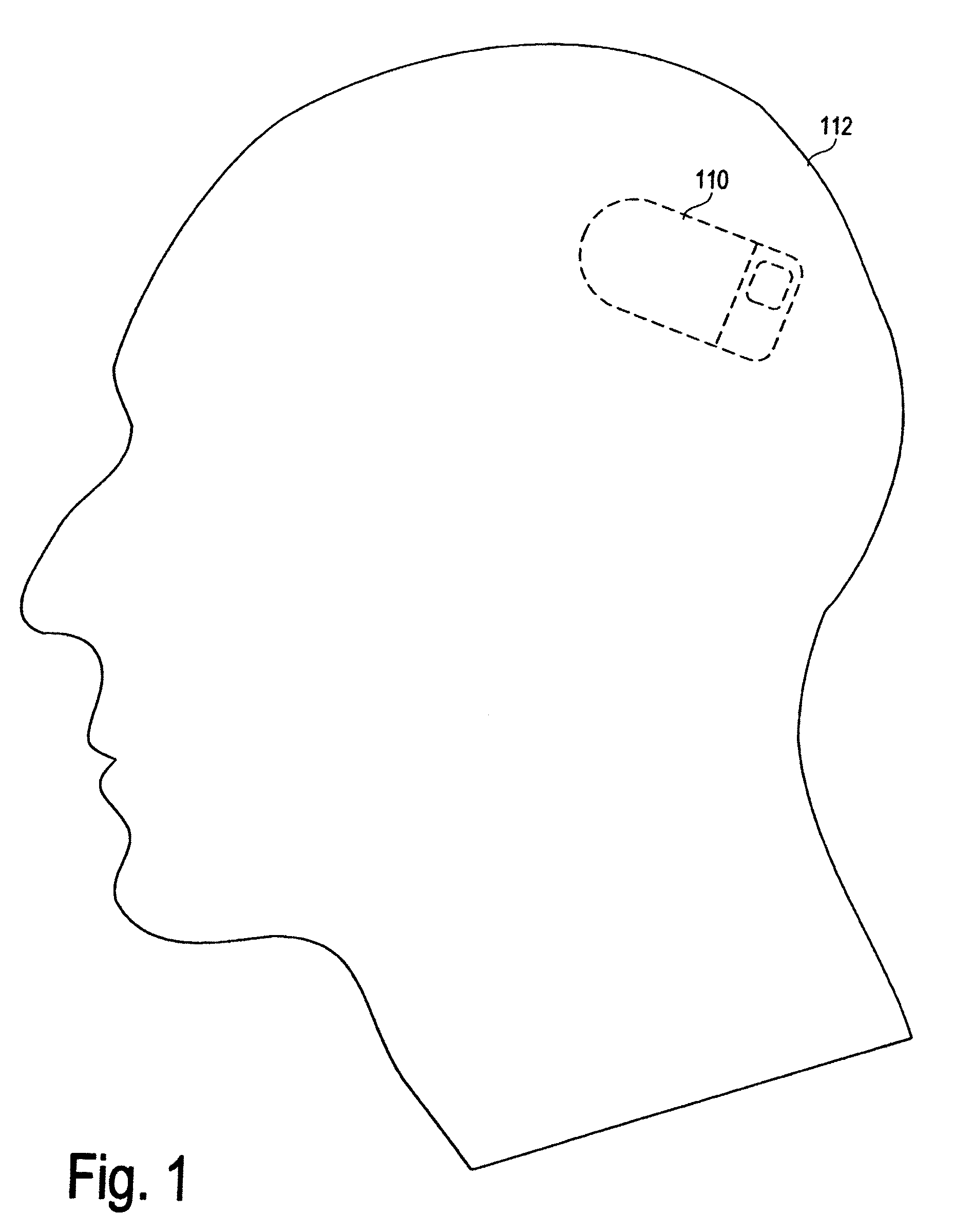 Implantable system enabling responsive therapy for pain