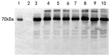 Novel fusion protein of glucagon-like peptide-1 (GLP-1) and human serum albumin as well as method for preparing fusion protein