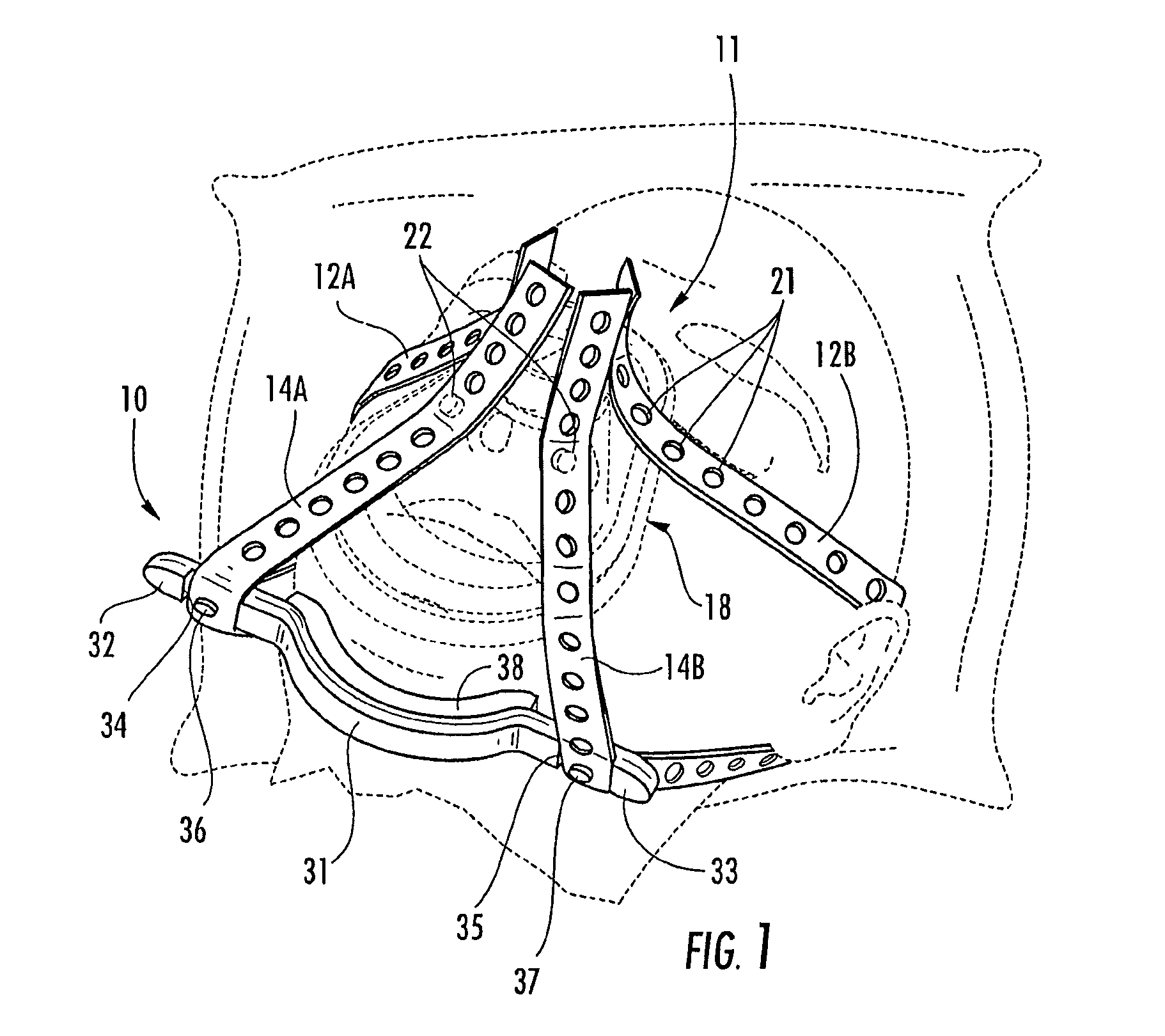 Ergonomic chin support for medical headgear