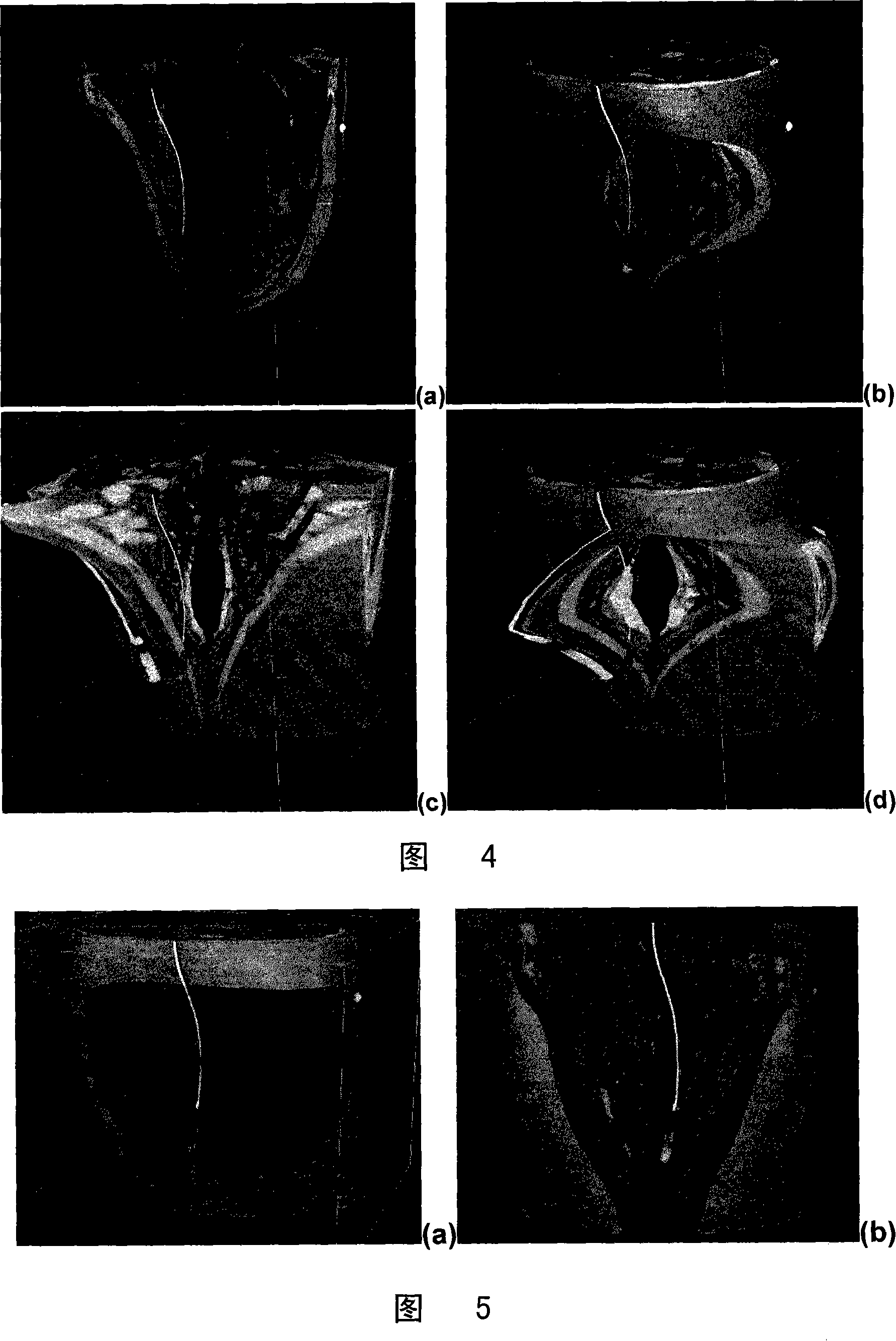 System and method for in-context volume visualization using virtual incision